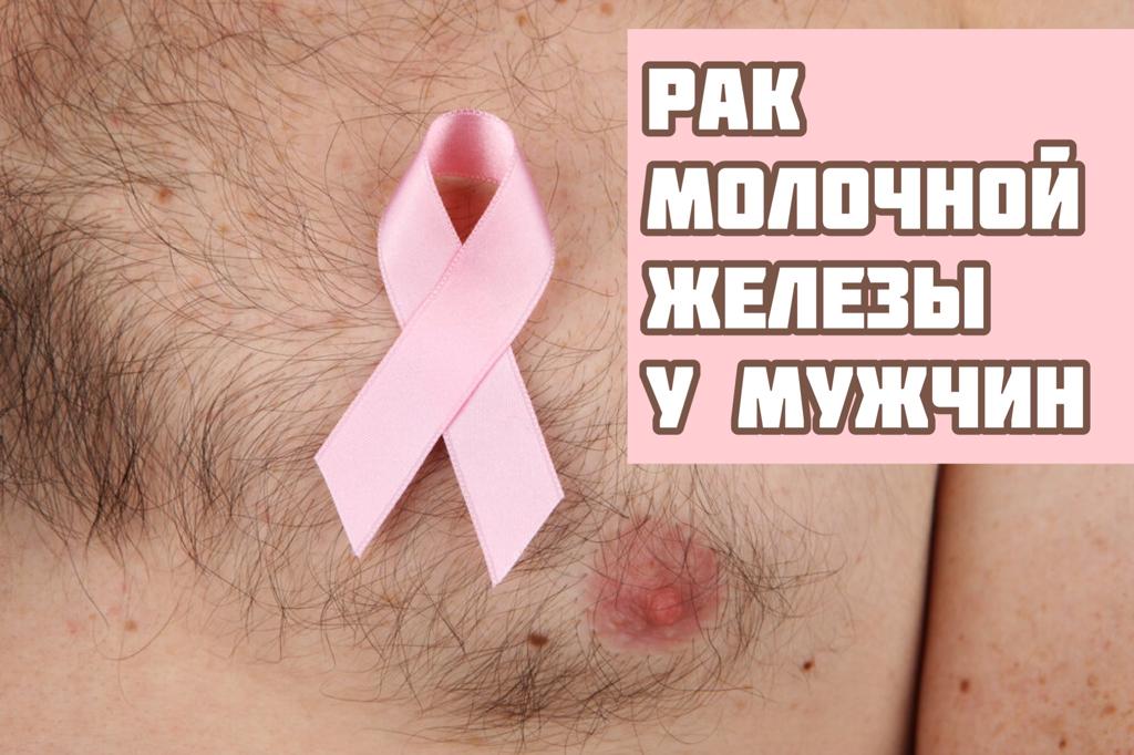 Рак молочной железы у мужчин